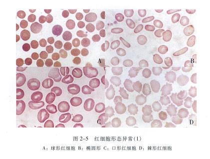 临床医学检验图红细胞形态异常1